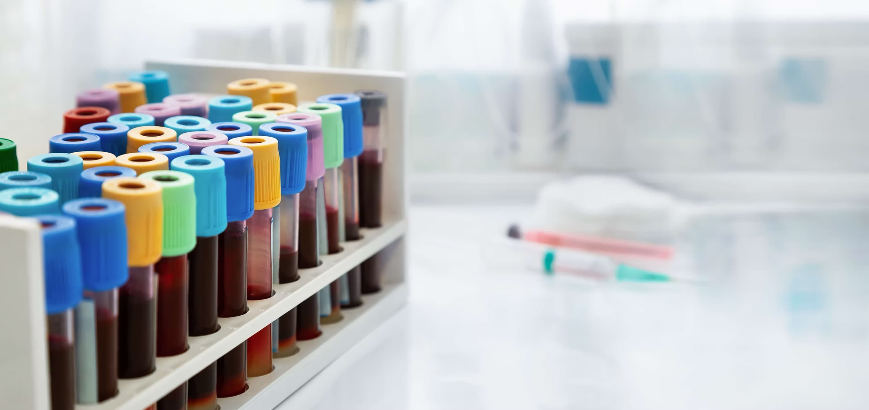 Professional phlebotomy services